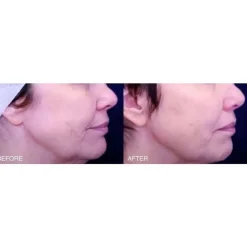 High Performance Face Cream