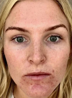 High Performance Face Serum
